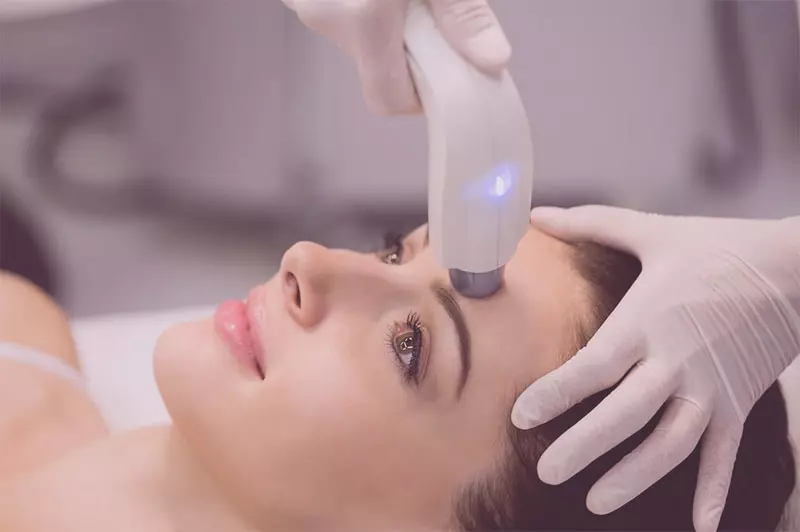 Rejuvenescimento por luz pulsada